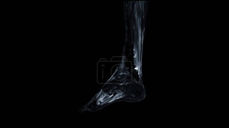 Téléchargez les photos : IRM FOOT scan Sagittal view T2 Technique de suppression des graisses pour le diagnostic des lésions tendineuses. - en image libre de droit