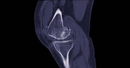 Photo for CT Scan of Knee joint for medical background . - Royalty Free Image