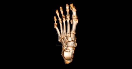 Téléchargez les photos : Balayage 3D des pieds pour le diagnostic des maladies des pieds par CT-SCANNER . - en image libre de droit