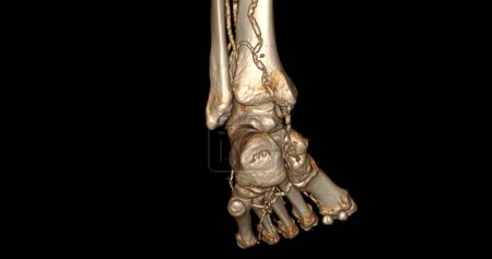 Photo for Foot 3D Scan for diagnosis foot diseases by CT-SCANNER . - Royalty Free Image