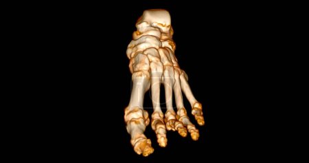 Photo for Foot 3D Scan for diagnosis foot diseases by CT-SCANNER . - Royalty Free Image