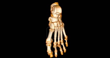 Téléchargez les photos : Balayage 3D des pieds pour le diagnostic des maladies des pieds par CT-SCANNER . - en image libre de droit
