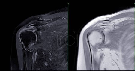 Photo for Magnetic Resonance Imaging or MRI of Shoulder Joint  for diagnostic shoulder pain. - Royalty Free Image