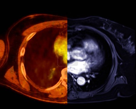 Photo for PET CT-SCAN and MRI in Axial view. - Royalty Free Image