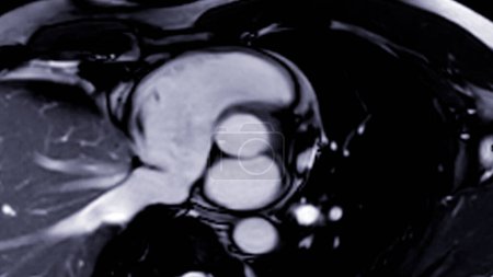Cardiac MRI images are instrumental in assessing cardiac health, identifying heart abnormalities, and guiding treatment plans.