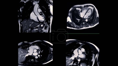 Photo for Cardiac MRI images are instrumental in assessing cardiac health, identifying heart abnormalities, and guiding treatment plans. - Royalty Free Image