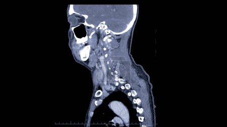 Ein CT-Scan des Hals sagittal Ansicht für Diagnosetechnik ist wichtig für die Beurteilung Halswirbel, Weichteile, und die Erkennung von Anomalien oder Verletzungen.