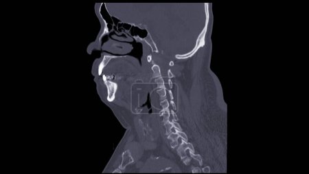 Téléchargez les photos : Une tomodensitométrie de la vue sagittale du cou pour la technique de diagnostic est essentielle pour évaluer les vertèbres cervicales, les tissus mous et détecter les anomalies ou les blessures. - en image libre de droit