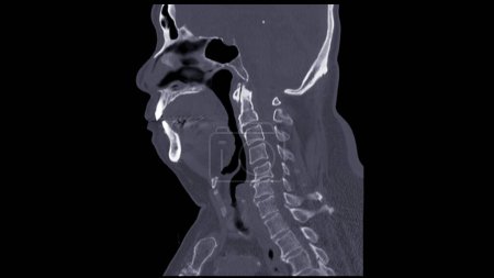 Téléchargez les photos : Une tomodensitométrie de la vue sagittale du cou pour la technique de diagnostic est essentielle pour évaluer les vertèbres cervicales, les tissus mous et détecter les anomalies ou les blessures. - en image libre de droit