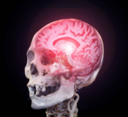 MRI brain scans fusion with skull 3D rendering.