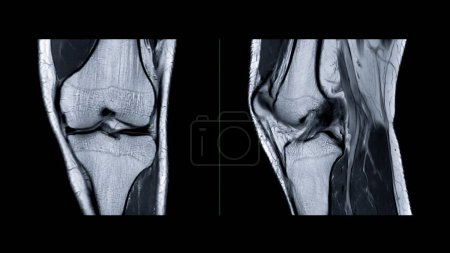 Magnetic resonance imaging or MRI of  knee joint. This diagnostic technique is crucial for assessing ligaments, cartilage, and identifying issues like tears or inflammation.