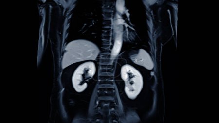 Photo for MRI of the upper abdomen coronal view is a non-invasive imaging technique providing detailed visuals of organs like the liver, pancreas, and kidneys. - Royalty Free Image