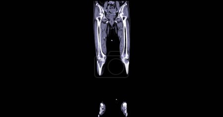 Foto de Un venograma por TC de la pierna es un procedimiento de imagen no invasivo que ofrece imágenes detalladas de las venas de las piernas.. - Imagen libre de derechos