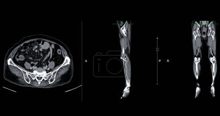 Photo for A CT venogram of the leg is a non-invasive imaging procedure offering detailed visuals of leg veins. - Royalty Free Image