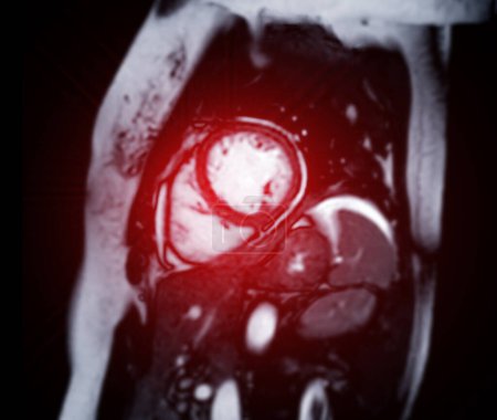 Cardiac MRI images are instrumental in assessing cardiac health, identifying heart abnormalities, and guiding treatment plans.