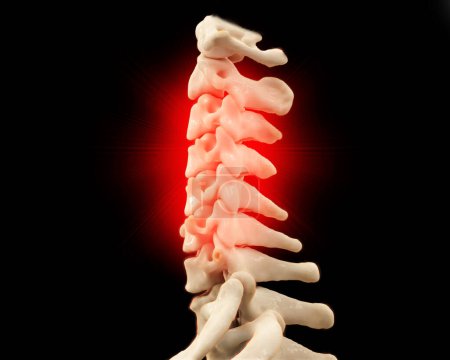 Photo for CT scan of C-Spine or Cervical spine 3D rendering . - Royalty Free Image