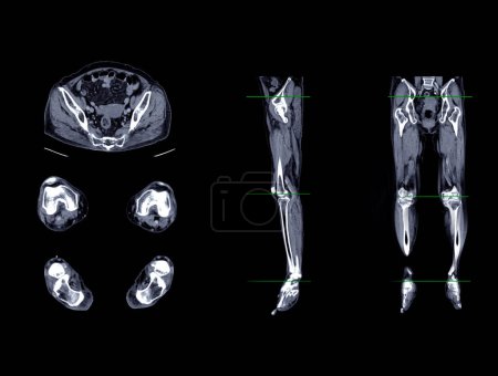 Ein CT-Venogramm des Beines ist ein nicht-invasives bildgebendes Verfahren, das detaillierte Visualisierungen der Beinvenen ermöglicht..
