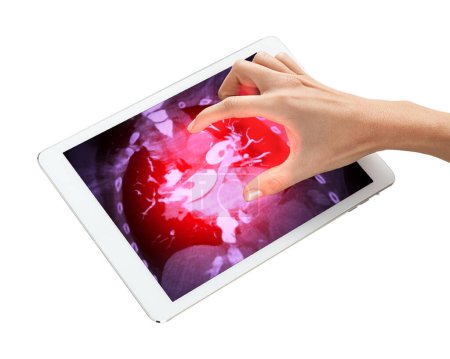 La main dans l'image guide votre attention sur la tablette, où une représentation visuelle représente une embolie pulmonaire, ce qui facilite la compréhension..