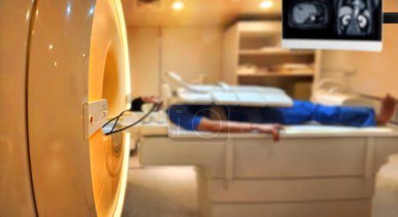 Un paciente se acuesta cómodamente en el escáner de resonancia magnética, sometiéndose a una resonancia magnética relajante para evaluar la parte superior del abdomen, proporcionando información médica crucial..