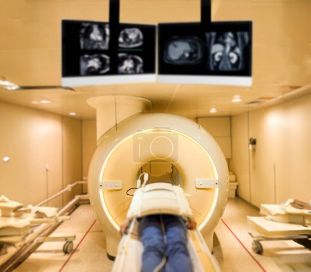 Un patient s'allonge confortablement sur le scanner IRM, subissant une IRM relaxante pour évaluer le haut de l'abdomen, fournissant des informations médicales cruciales.