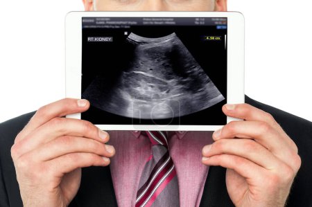 Utilizing his tablet, the man showcases a clear ultrasound image of the kidney, making the complex anatomy accessible and understandable.