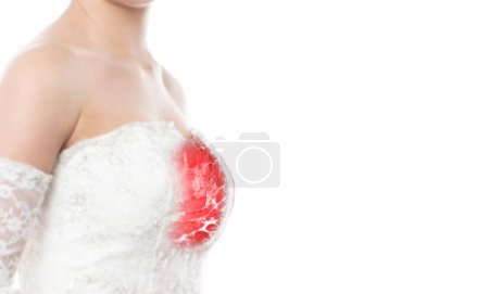 Photo for During Breast Cancer Awareness Month, an MRI breast image on a woman's chest raises awareness, emphasizing early detection and support.Clipping path. - Royalty Free Image