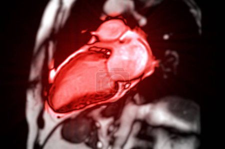 Cardiac MRI evaluates heart health, providing detailed images for diagnosing cardiovascular conditions and planning treatment