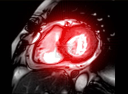 La resonancia magnética cardiaca evalúa la salud cardiaca, proporcionando imágenes detalladas para diagnosticar afecciones cardiovasculares y planificar el tratamiento