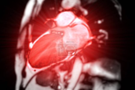 Herz-MRT wertet Herzgesundheit aus und liefert detaillierte Bilder zur Diagnose kardiovaskulärer Erkrankungen und zur Planung der Behandlung