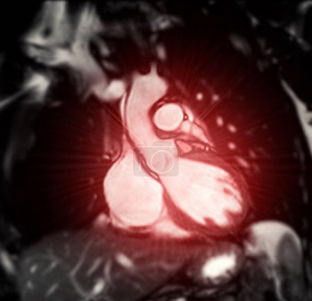 Herz-MRT wertet Herzgesundheit aus und liefert detaillierte Bilder zur Diagnose kardiovaskulärer Erkrankungen und zur Planung der Behandlung