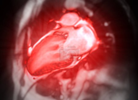 IRM cardiaque évalue la santé cardiaque, fournissant des images détaillées pour diagnostiquer les maladies cardiovasculaires et planifier le traitement
