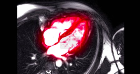 IRM cardiaque évalue la santé cardiaque, fournissant des images détaillées pour diagnostiquer les maladies cardiovasculaires et planifier le traitement