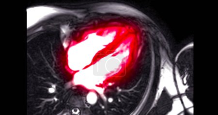 La resonancia magnética cardiaca evalúa la salud cardiaca, proporcionando imágenes detalladas para diagnosticar afecciones cardiovasculares y planificar el tratamiento