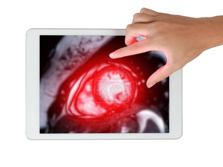 Cardiac MRI images  on Tablet are instrumental in assessing cardiac health, identifying heart abnormalities isolated on white background,.Clipping path.