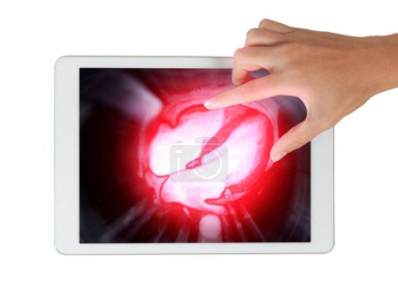 Las imágenes de resonancia magnética cardiaca en la tableta son fundamentales para evaluar la salud cardiaca, identificando anomalías cardiacas aisladas en el fondo blanco..