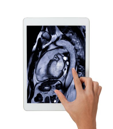 MRT-Bilder auf dem Tablet sind entscheidend bei der Beurteilung der Herzgesundheit, bei der Identifizierung von Herzanomalien, die auf weißem Hintergrund isoliert sind..