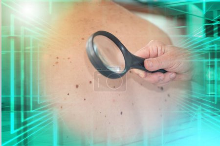 Téléchargez les photos : Dermatologue examinant la peau du dos du patient ; exposition multiple - en image libre de droit