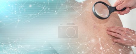 Téléchargez les photos : Dermatologue examinant la peau du dos du patient ; bannière panoramique - en image libre de droit