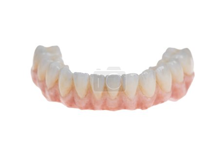 Foto de Atención de salud dental. Circonio cerámico en versión final. prótesis dental de cerca sobre implantes de óxido de circonio, aislado en blanco - Imagen libre de derechos