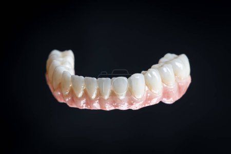 Téléchargez les photos : Soins dentaires. Fermer zirconium céramique. Prothèse dentaire sur implants d'oxyde de zirconium - en image libre de droit
