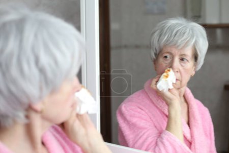 Téléchargez les photos : Portrait en gros plan de femme mature avec saignement du nez devant le miroir dans la salle de bain - en image libre de droit