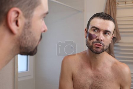 Téléchargez les photos : Portrait de jeune homme avec une grosse tache de naissance sur le visage devant le miroir dans la salle de bain - en image libre de droit