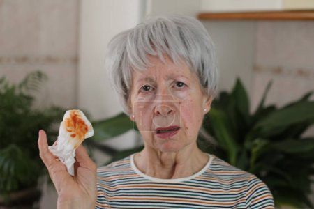 Téléchargez les photos : Portrait de femme mûre aux cheveux gris souffrant tenant une serviette avec du sang à la maison - en image libre de droit