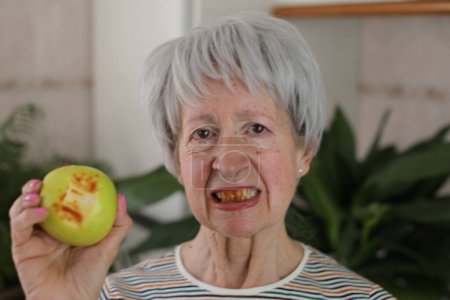 Téléchargez les photos : Femme âgée avec des gencives sanglantes après avoir mordu une pomme - en image libre de droit