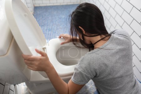 Foto de Mujer borracha vomitando resaca en el inodoro. Las mujeres tienen dolor abdominal, náuseas, mareos, náuseas, vómitos debido a la intoxicación alimentaria. - Imagen libre de derechos