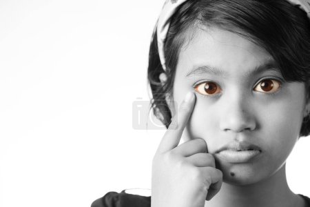 Vista cercana monocromática del ojo amarillo rojizo de una niña india, concepto de cuidado de la salud