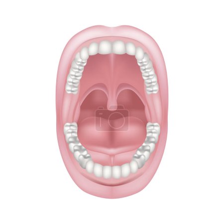 Illustration for Short frenum of the tongue. Pathology of the oral cavity. Anatomy of the teeth. Vector illustration - Royalty Free Image
