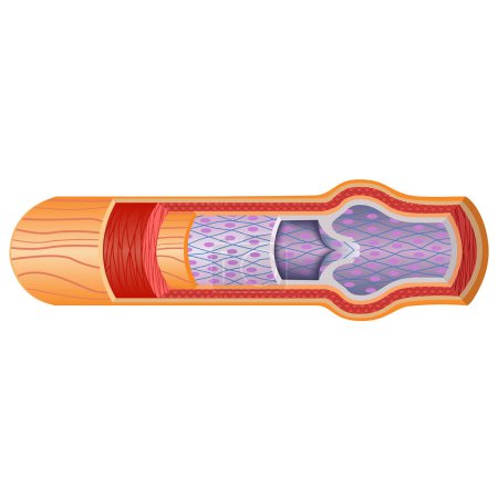 Illustration for Artery and valve structure. Vienna in cross section. Vector illustration - Royalty Free Image
