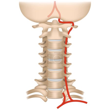 Illustration for Vertebral artery syndrome. Cervical spine. Vertebro basilar pool. Veins leading to the cerebellum. Vector illustration. - Royalty Free Image
