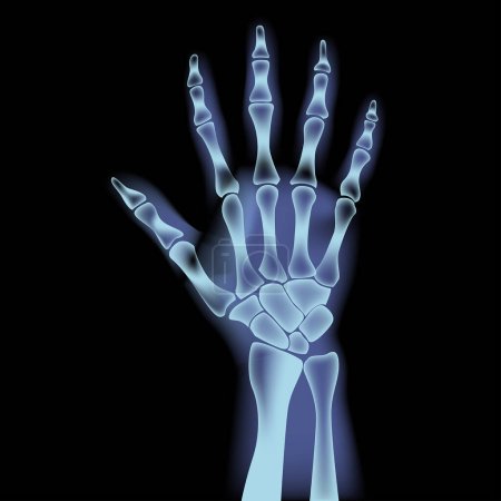Illustration for Human hand in x-rays. The bones of the palm glow blue. Vector illustration - Royalty Free Image